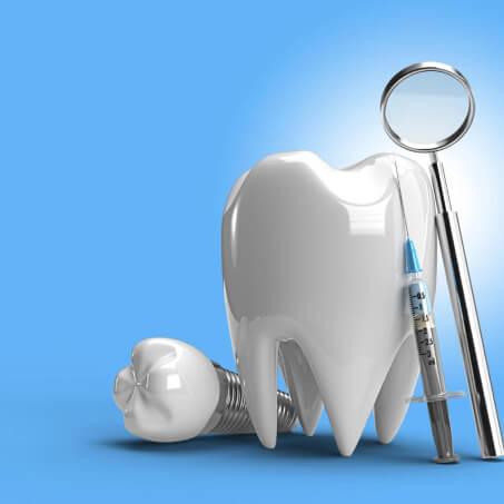 Dental Implants 3