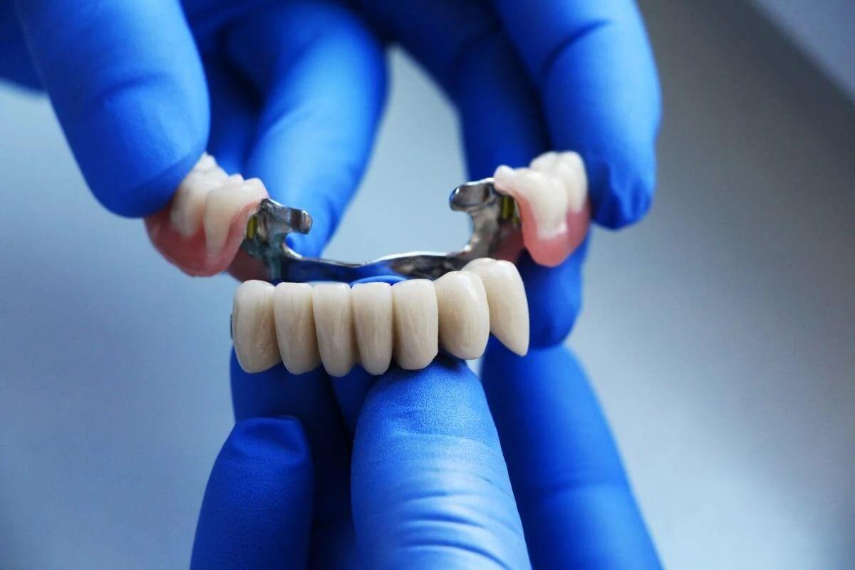Dental Bridges: Restoring Your Smile and Confidence