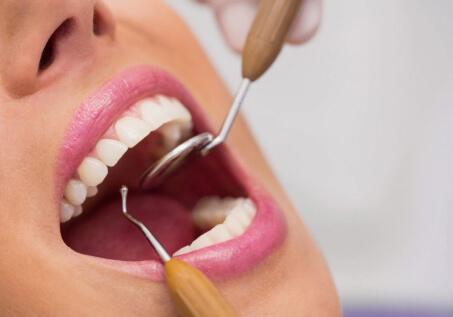 Diş beyazlatma kalıcı mıdır?